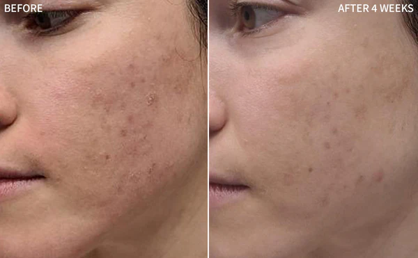 Innovative Hair Regrowth Treatment
