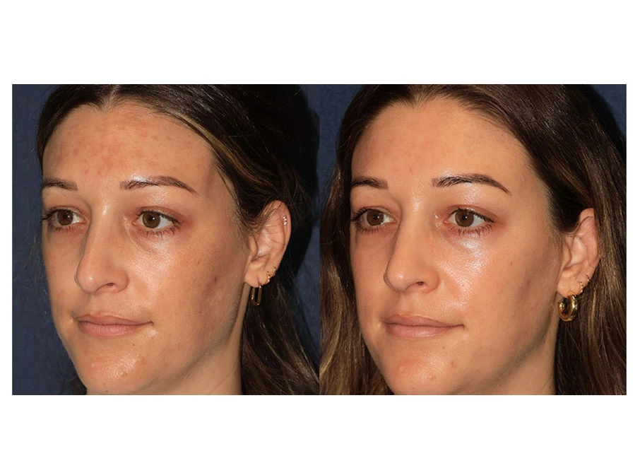 Innovative Hair Regrowth Treatment