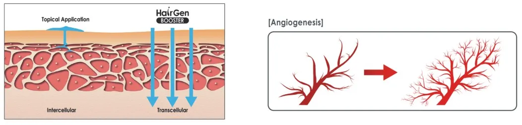 microneedling-results