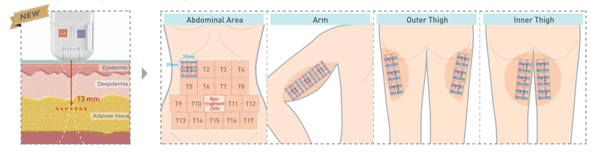 body-catridges